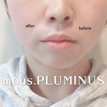 PLUMINUS/mous./美顔器・マッサージを使ったクチコミ（4枚目）