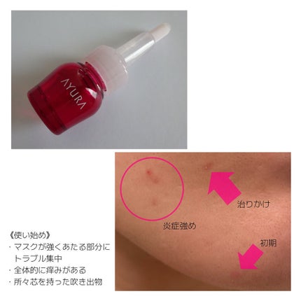 セラムオプティマイザー/AYURA/美容液を使ったクチコミ(5枚目)