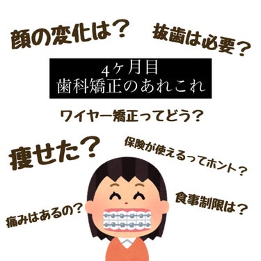 🦷 〜4ヶ月目〜歯科矯正のあれこれ 🦷

こんにちは⸜🌷︎⸝‍
ゆいちゃんまんです🦋


引っ越しやら何やらで久しぶりの投稿になります😥


今回は、矯正を始めて4ヶ月目の変化や
皆さんが気になってるで