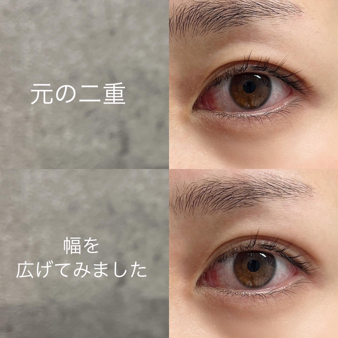 メザイク イージークリア 接着クリアタイプ/メザイク/二重まぶた用アイテムを使ったクチコミ（2枚目）