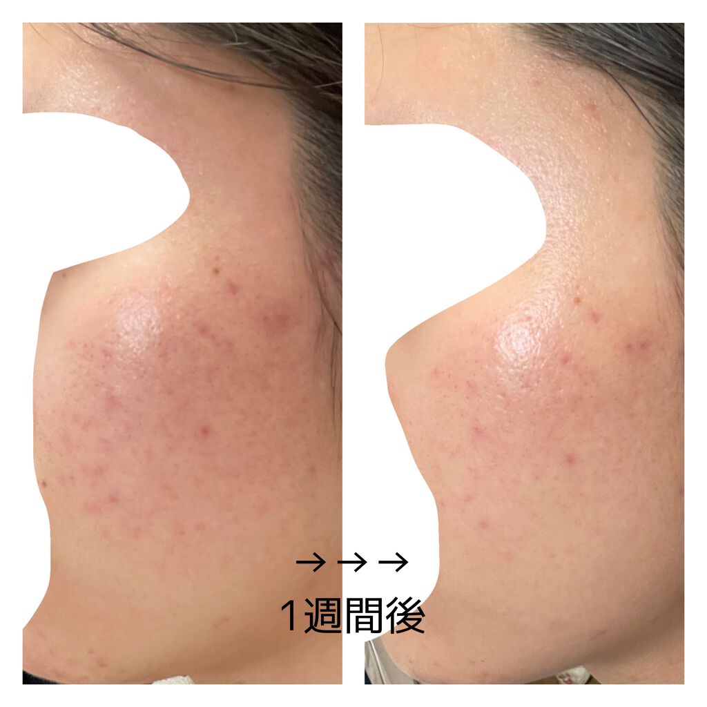 㪠㪠ð§žâ¡ on LIPS ããããæ¥èš7é±éç®2021/03/25ææŽé¡æããŒãããã¹ã¿é..ãïŒ3æç®ïŒ