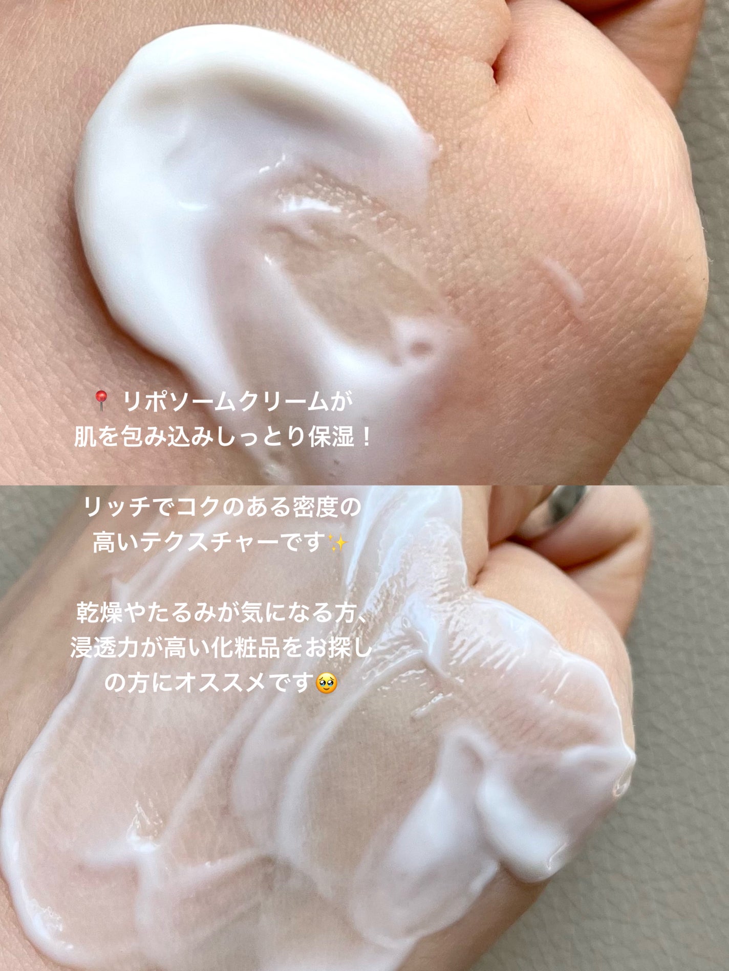 リードルショット100/VT/美容液を使ったクチコミ(5枚目)