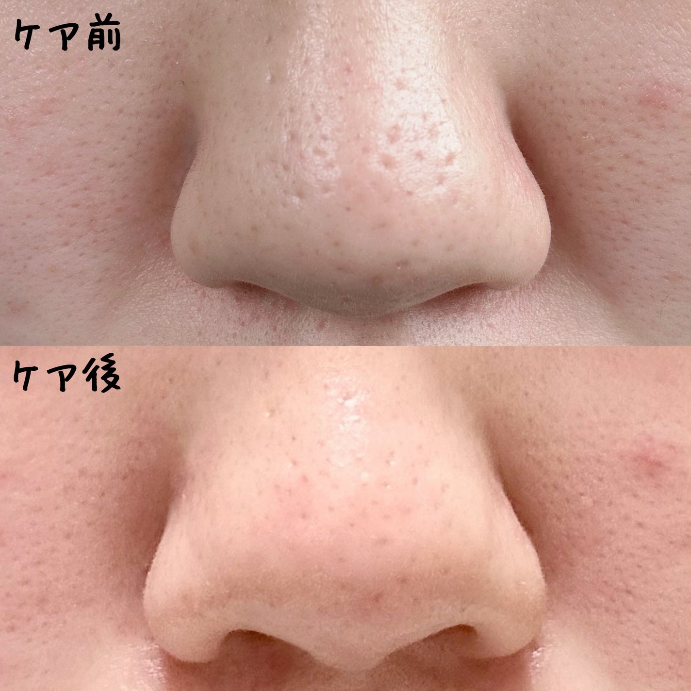 モリンガタイトニングポアセラム/ilso/美容液を使ったクチコミ(8枚目)