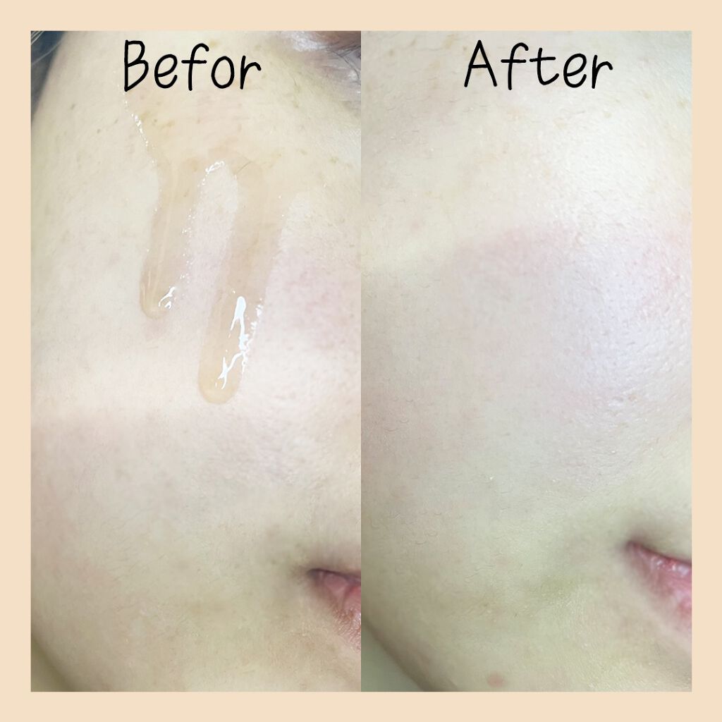 ビフィダバイオームコンプレックスセラム/manyo/美容液を使ったクチコミ（3枚目）