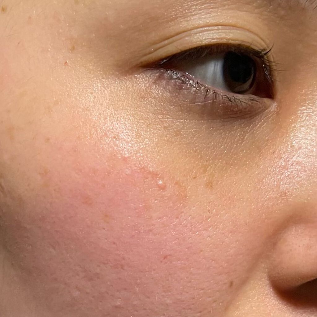 フルフィットプロポリスライトアンプル/COSRX/美容液を使ったクチコミ(5枚目)