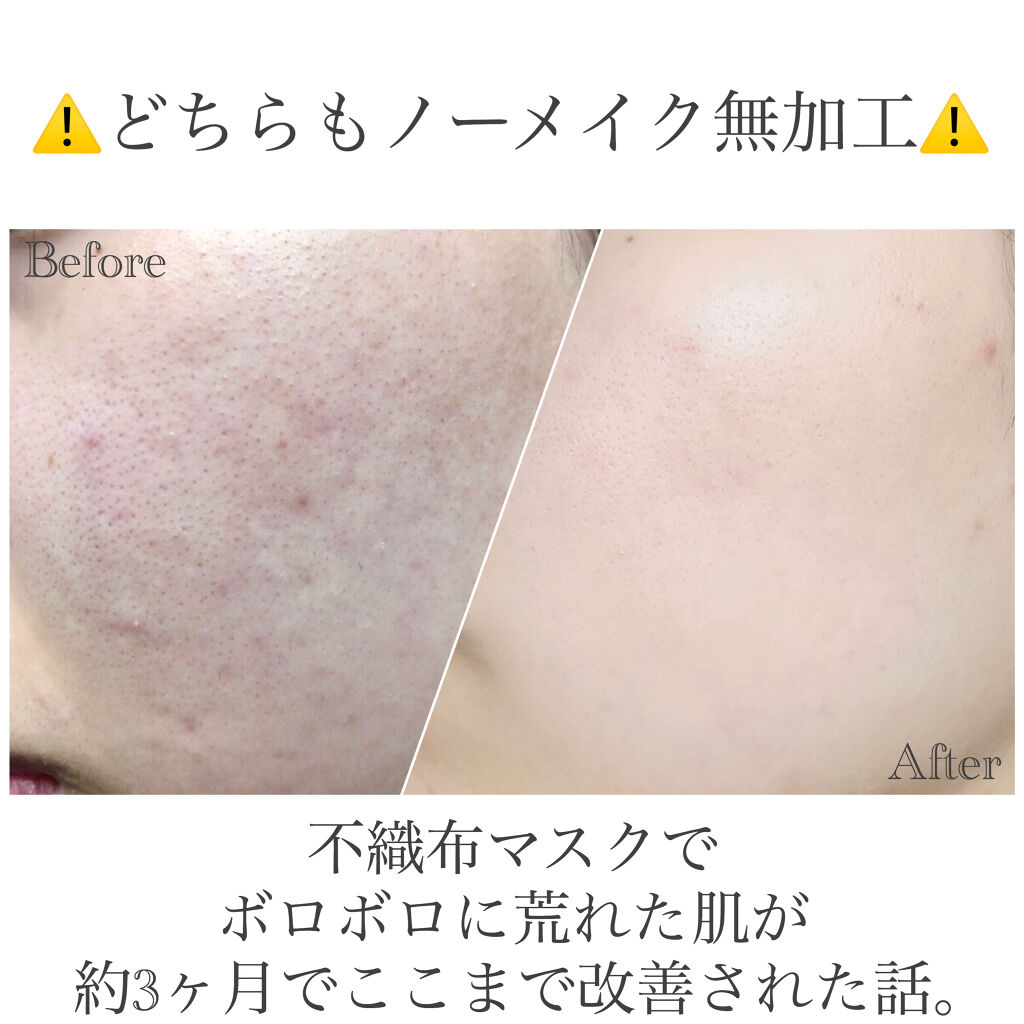 クリアブライト ローション/シュープリームノイ/化粧水を使ったクチコミ（1枚目）