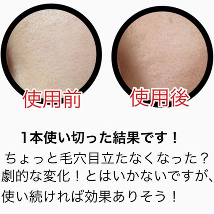 イチジク毛穴アンプル/Veganifect/美容液を使ったクチコミ(4枚目)