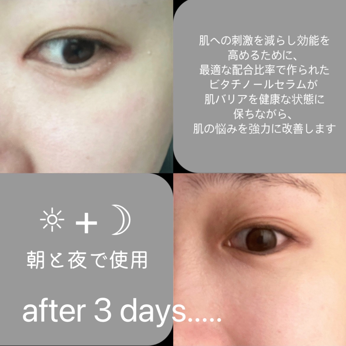 ユース ラディアンス ビタチノール セラム/primera/美容液を使ったクチコミ（3枚目）
