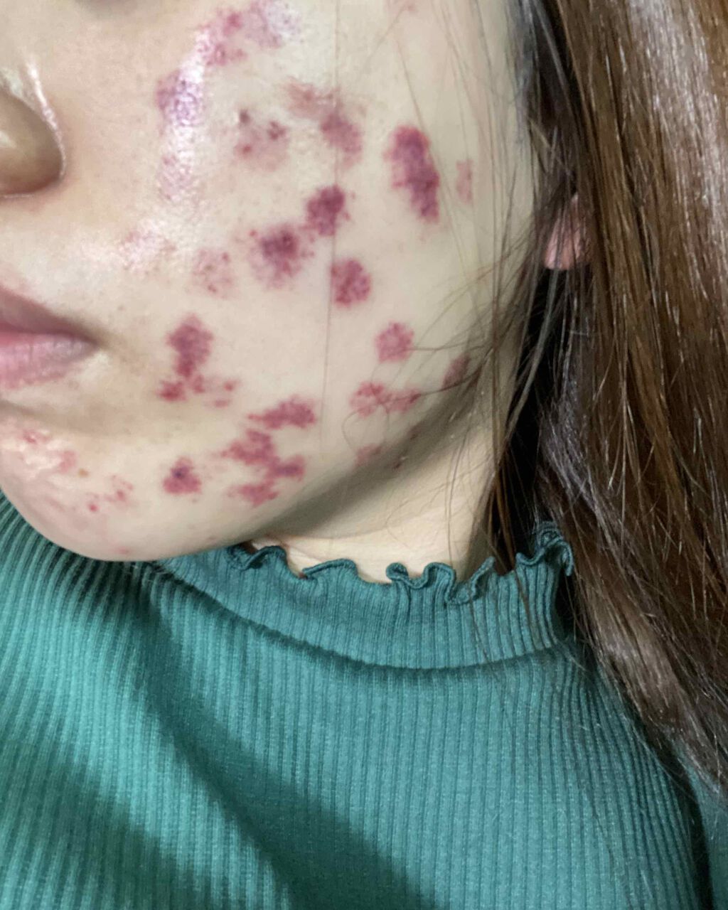 ルルルンプレシャス GREEN(バランス)【旧】/ルルルン/シートマスク・パックを使ったクチコミ(4枚目)