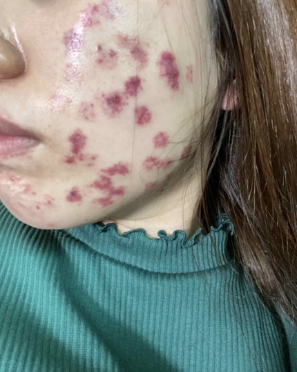 ルルルンプレシャス GREEN(バランス)【旧】/ルルルン/シートマスク・パックを使ったクチコミ(4枚目)