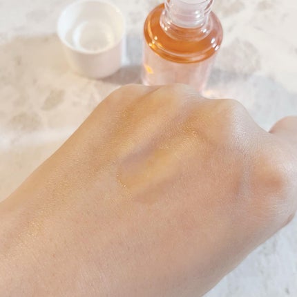 ひとみん on LIPS 「小林製薬様から商品提供をいただきましたニキビは出来なくなって..」(5枚目)