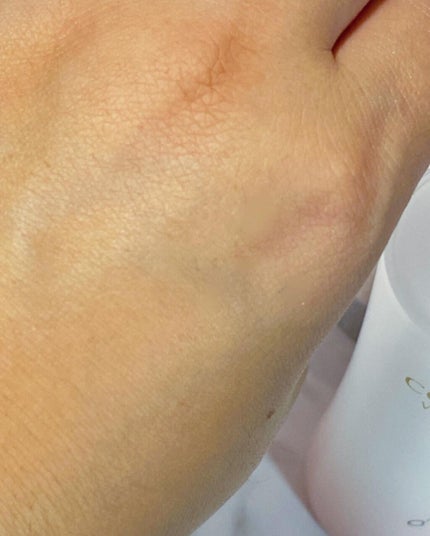 リンクルホワイトローション/コラリッチ/化粧水を使ったクチコミ(5枚目)