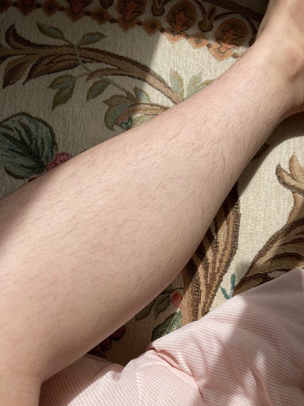 光美容器KE-NON(ケノン)/エムテック/家庭用脱毛器を使ったクチコミ(8枚目)