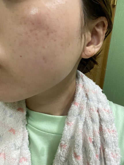 お米のマスク/毛穴撫子/シートマスク・パックを使ったクチコミ(4枚目)