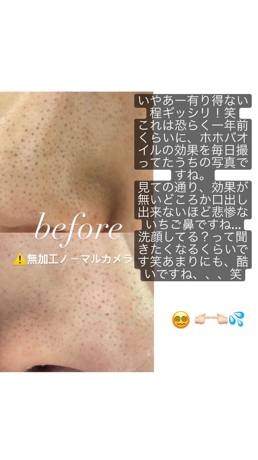 ma__chan on LIPS 「⚠️今回私が紹介するのは「無理矢理」でもいちご鼻を消したい!!..」(2枚目)