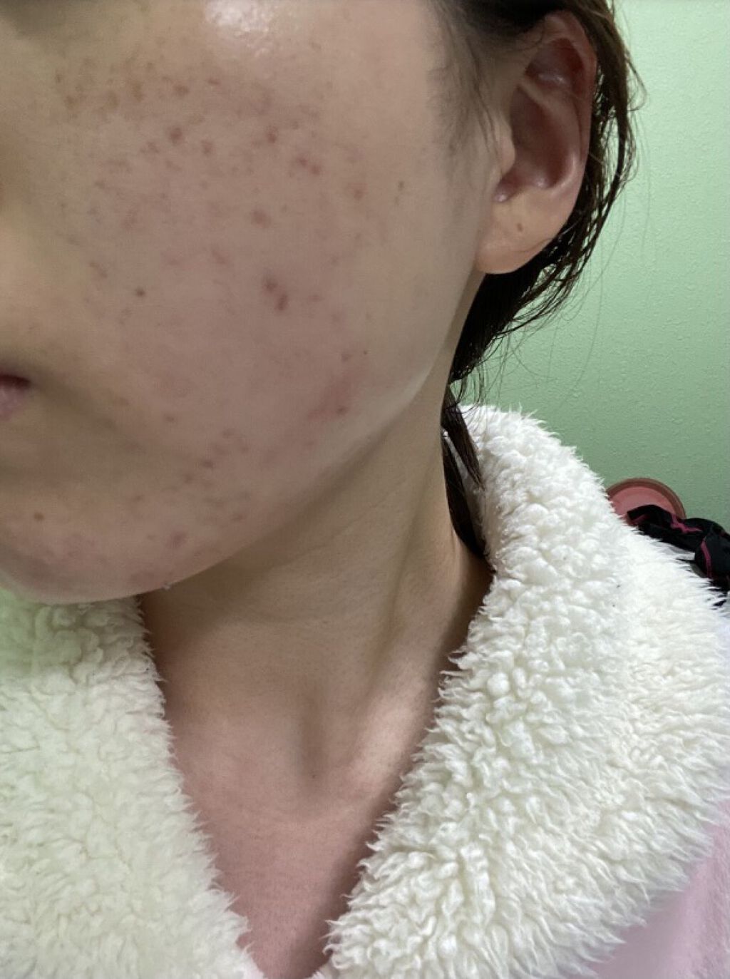 ブライト＆バウンシングローション（ミスト）/ジュレリッチ/ミスト状化粧水を使ったクチコミ（3枚目）