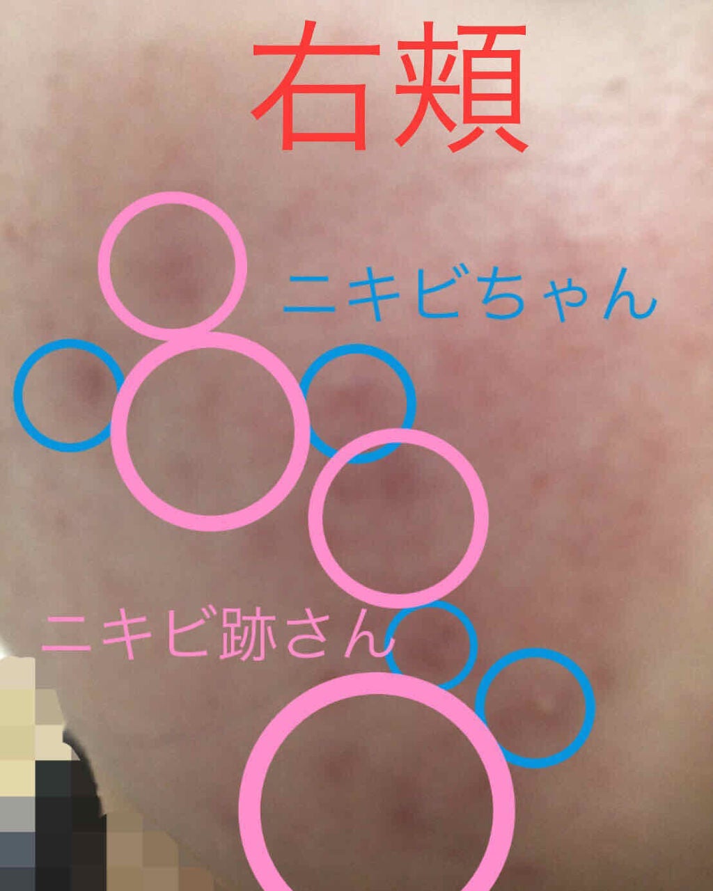 ハトムギ化粧水(ナチュリエ スキンコンディショナー R )/ナチュリエ/化粧水を使ったクチコミ(3枚目)