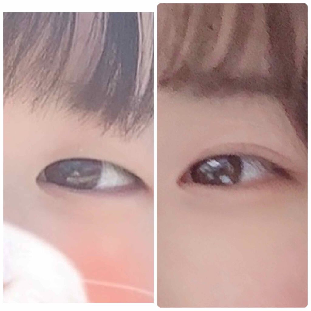 アイトーク/アイトーク/二重まぶた用アイテムを使ったクチコミ（2枚目）