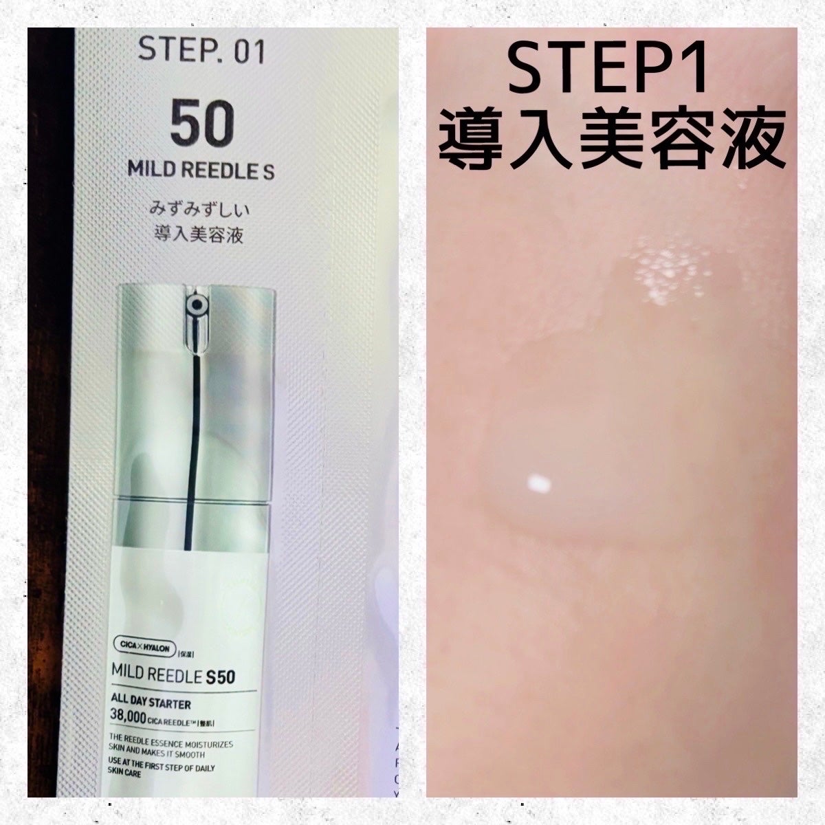 マイルドリードルS 50 2ステップマスク/VT/シートマスク・パックを使ったクチコミ(2枚目)