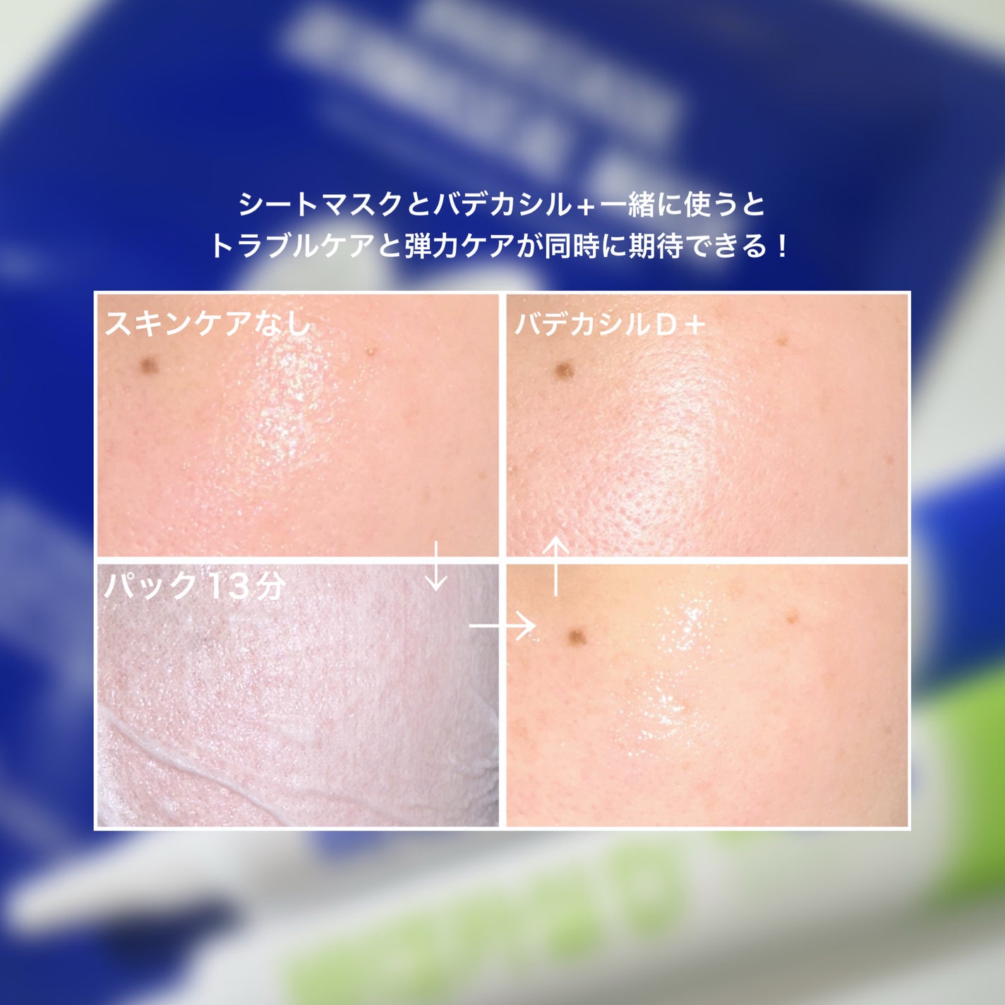 BADECASIL DERMASEAL MASK/23years old/シートマスク・パックを使ったクチコミ(6枚目)