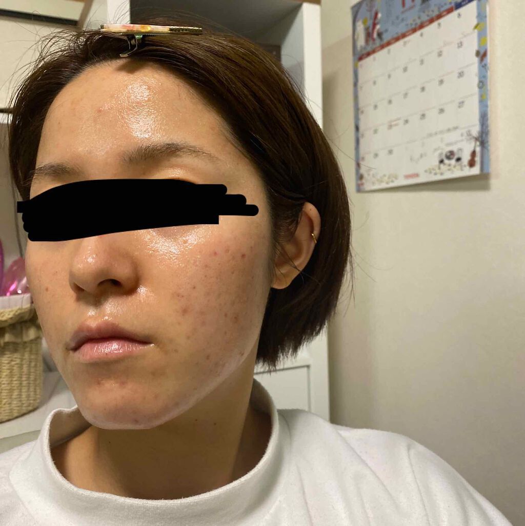 UVマイルドジェルN/マミー/日焼け止めジェルを使ったクチコミ（3枚目）