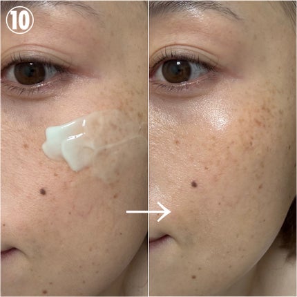 シカダーマヒットセラム5/KATAN/美容液を使ったクチコミ(6枚目)