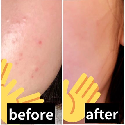 ワンステップグリーンカーミングパッド/COSRX/トナーパッドを使ったクチコミ(2枚目)