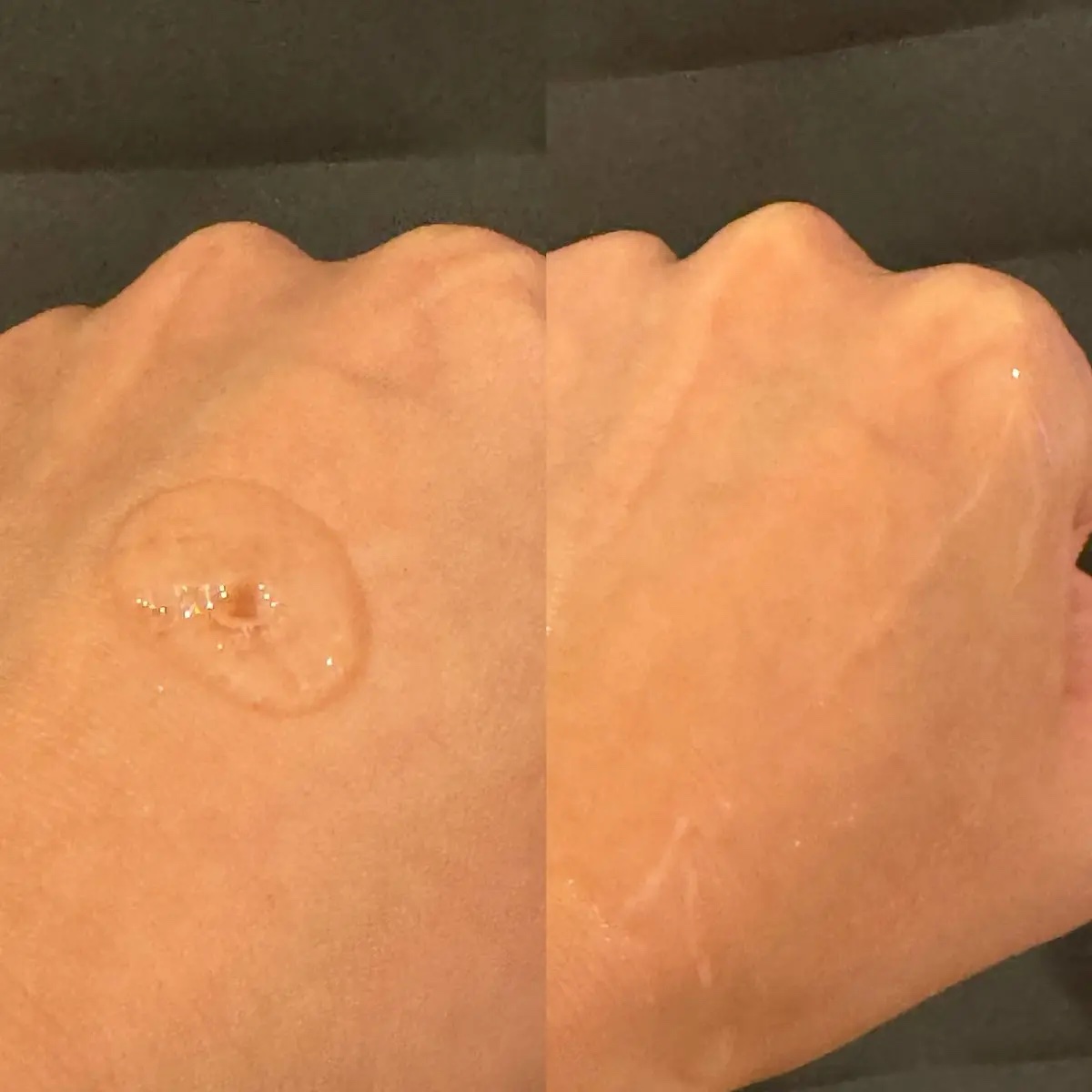 ミノン アミノモイスト エイジングケア ローション/ミノン/化粧水を使ったクチコミ（2枚目）