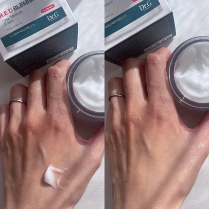 レッドブレミッシュ クリアモイスチャークリーム/Dr.G/フェイスクリームを使ったクチコミ(3枚目)