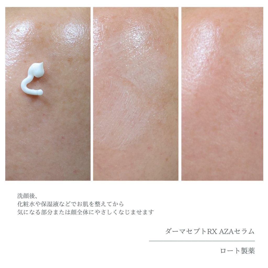 ダーマセプトRX AZAセラム｜ダーマセプトRXの口コミ - 〖美容医療発想