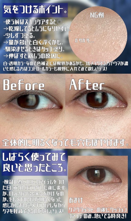 王様のクマクラッシャー/ビズゴールド/アイケア・アイクリームを使ったクチコミ(3枚目)