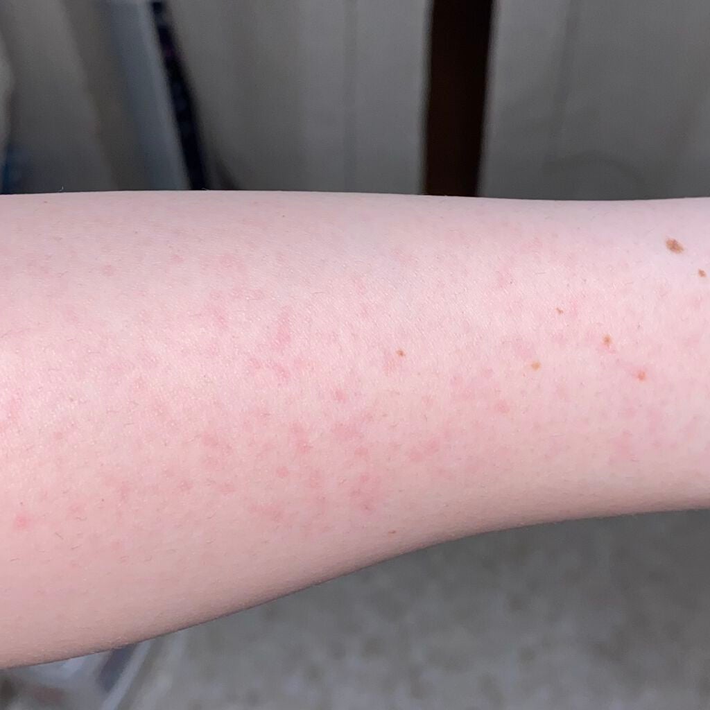 それな on LIPS 「ジョモタン使用感ぐだぐだレビュー!!写真は、使用前→使用後です..」(4枚目)