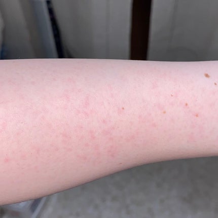 それな on LIPS 「ジョモタン使用感ぐだぐだレビュー!!写真は、使用前→使用後です..」(4枚目)