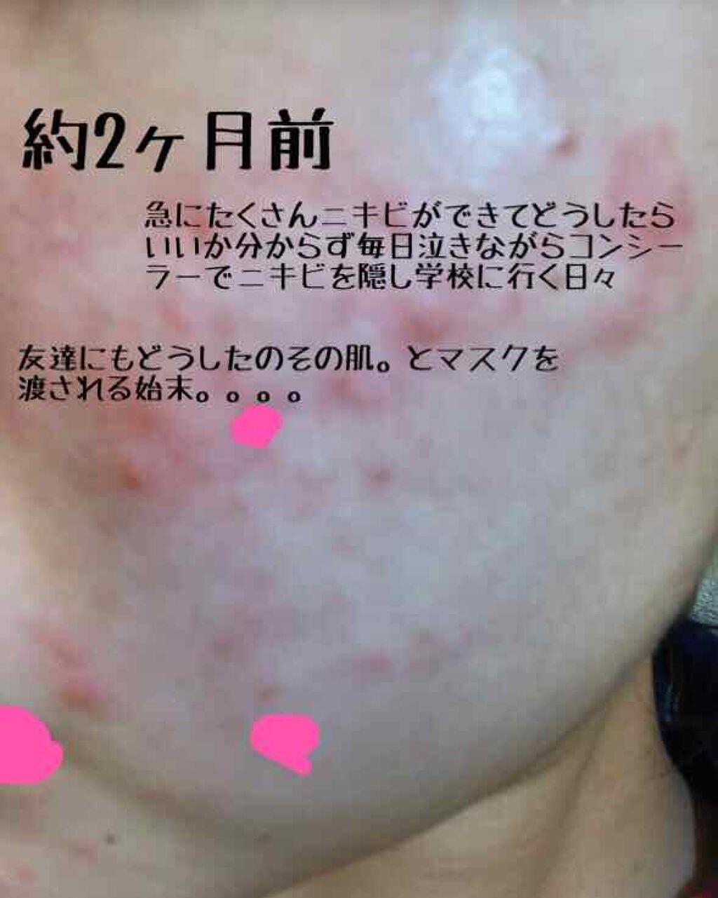 明色美顔水 薬用化粧水/美顔/化粧水を使ったクチコミ（2枚目）