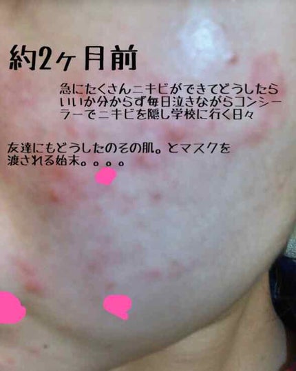 明色美顔水 薬用化粧水/美顔/化粧水を使ったクチコミ(2枚目)