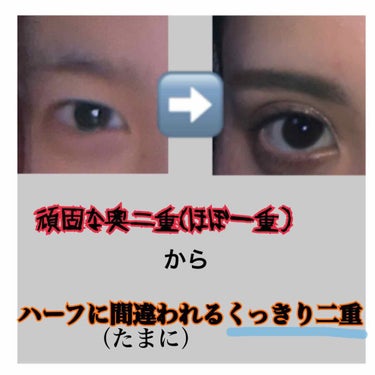 さえ on LIPS 「頑固な奥二重からくっきり二重にした方法！もちろん写真はアイプチ..」（1枚目）