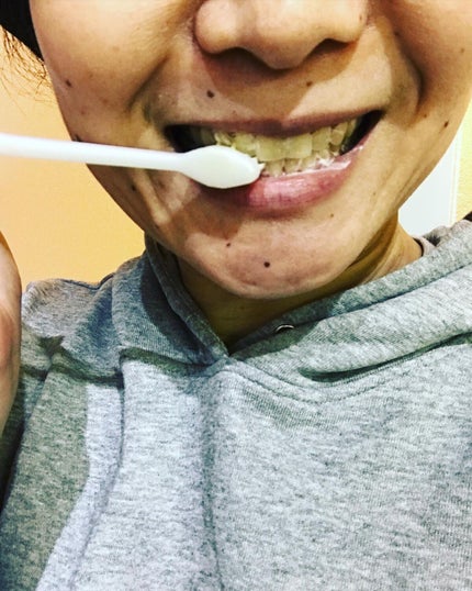 アパガードセレナ/アパガード/歯磨き粉を使ったクチコミ(7枚目)