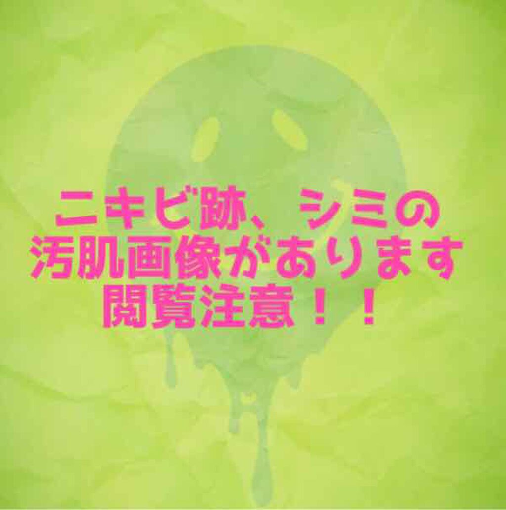 ラグジュアリーホワイト コンシーラーHQ/アンプルール/リキッドコンシーラーを使ったクチコミ（2枚目）