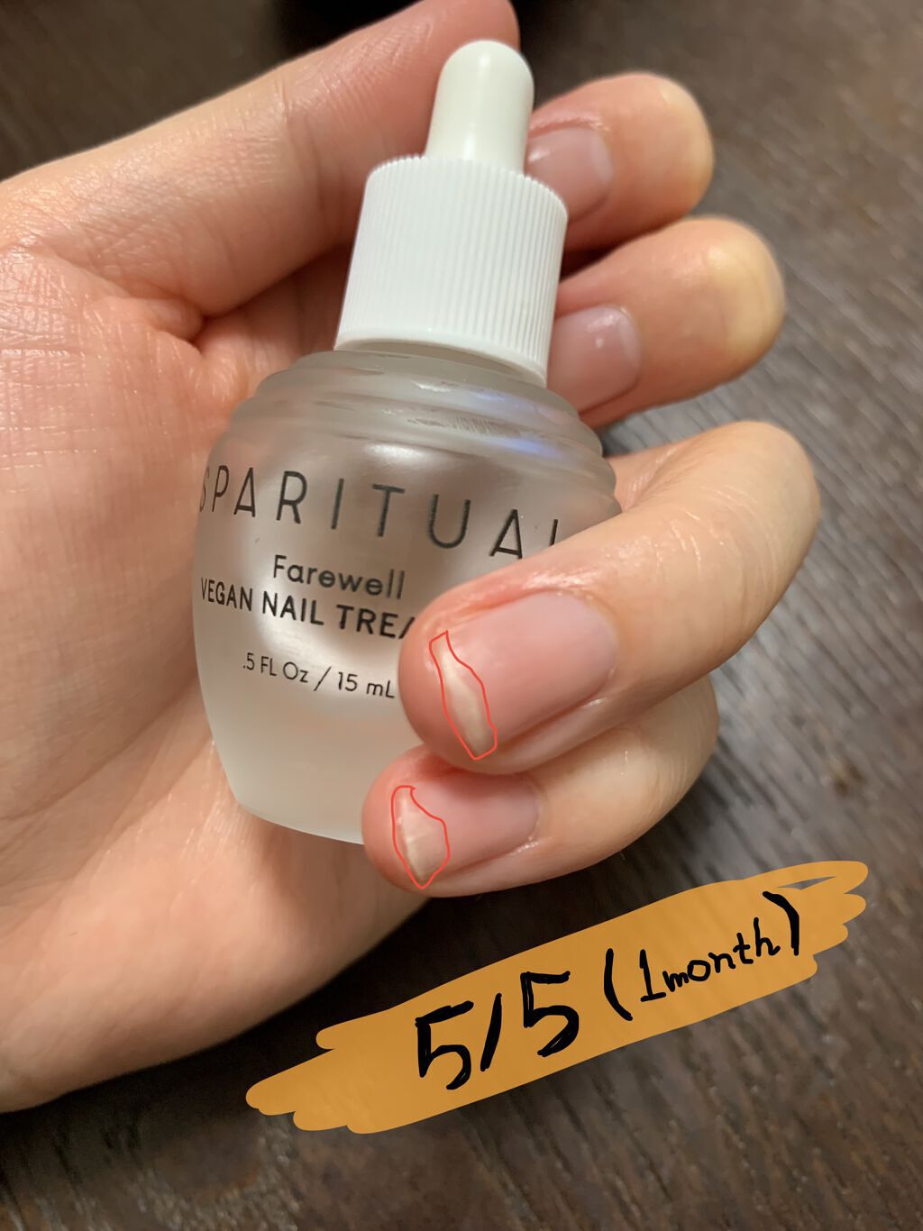 ありちゃのクチコミ「５/５追加
薬指気にならないぐらいに伸びた。
小指は半分ぐらい剥離消失した。

爪の表面凸凹し.....」（2枚目）