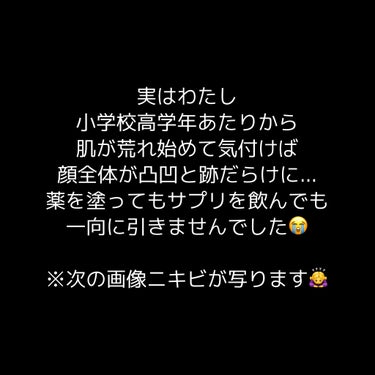 マヌカラ クリアモイストローション マヌカハニー化粧水のクチコミ「今回もご覧いただきありがとうございます。
少しでも皆様の力になれれば嬉しいです🙇‍♀️

今回.....」（2枚目）