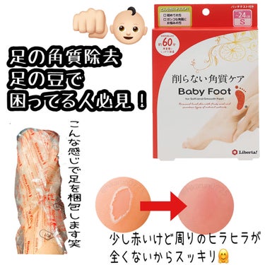 ベビーフット (Baby Foot)
ベビーフット イージーパック 
SPT60分タイプ Sサイズ(〜24cm)


〜購入経緯〜
仕事で歩きすぎて足裏の皮が剥けてしまった😱
日中は絆創膏で保護するも絆