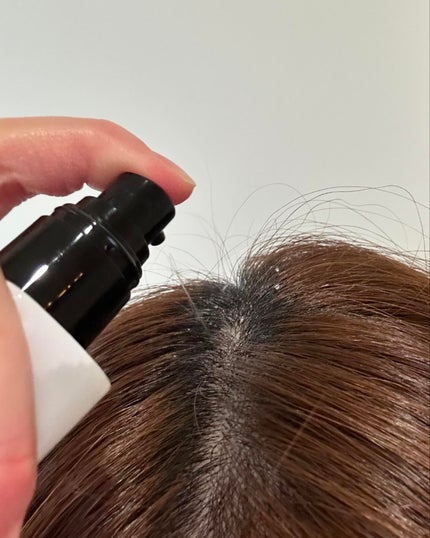 チャップアップ育毛ローション/CHAP UP(チャップアップ)/頭皮ローションを使ったクチコミ(4枚目)