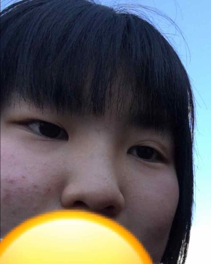 アイビューティー フィクサー WP/アストレア ヴィルゴ/二重まぶた用アイテムを使ったクチコミ(2枚目)