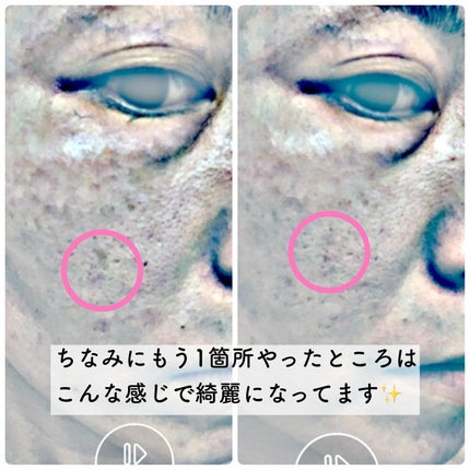 SBC ナノメソッドHQ/SBC/フェイスクリームを使ったクチコミ(10枚目)