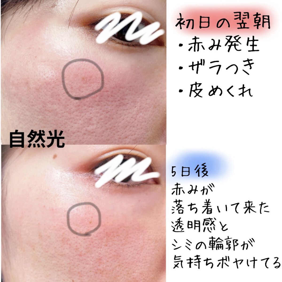 ハイドロクリームPHQ-8/KISO/美容液を使ったクチコミ（2枚目）