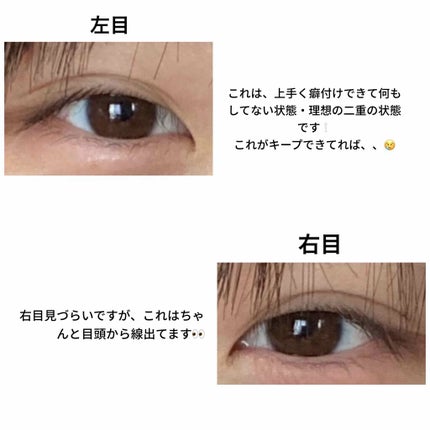 アイビューティー フィクサー WP/アストレア ヴィルゴ/二重まぶた用アイテムを使ったクチコミ(3枚目)