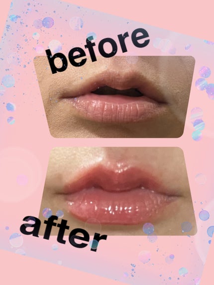 ボリュームリッププランパー/BANILA CO/リッププランパーを使ったクチコミ(1枚目)