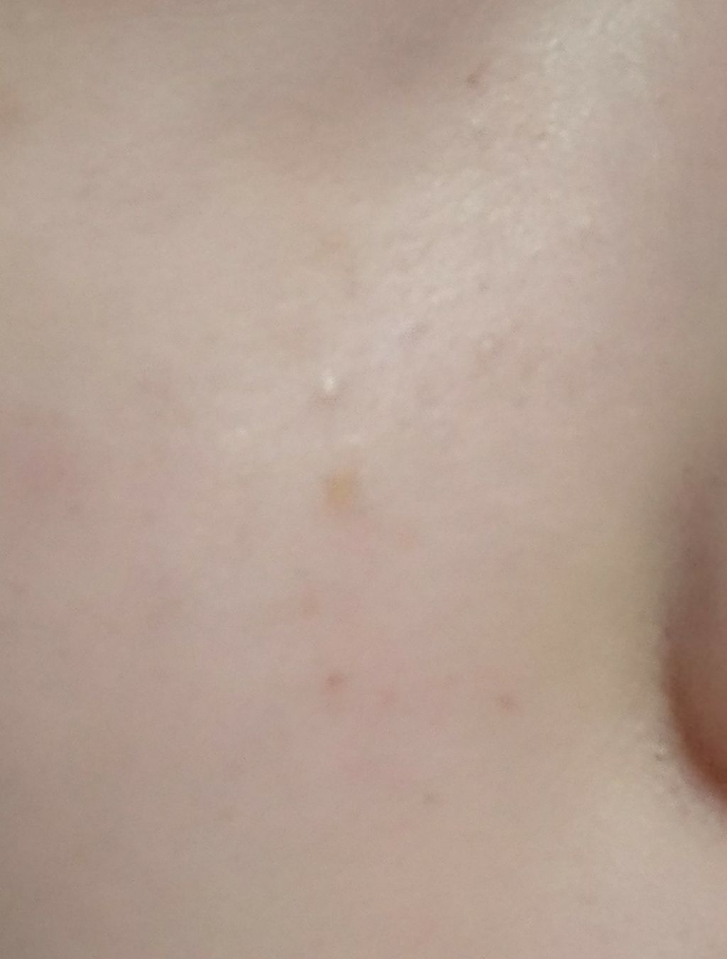 フィットミー コンシーラー/MAYBELLINE NEW YORK/リキッドコンシーラーを使ったクチコミ(2枚目)