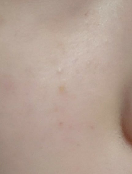 フィットミー コンシーラー/MAYBELLINE NEW YORK/リキッドコンシーラーを使ったクチコミ(2枚目)