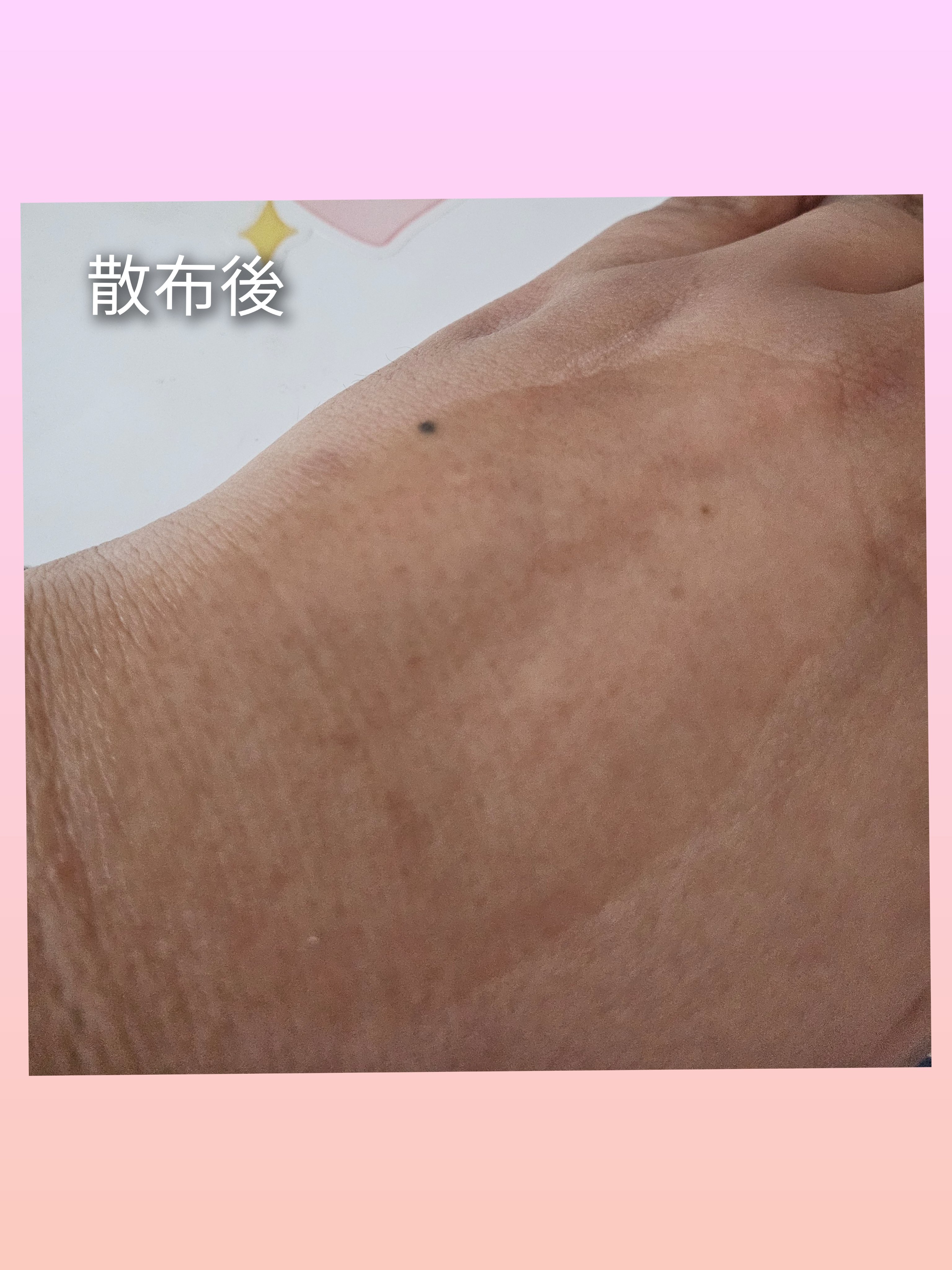 復活草ビフィダセラムファーミングドロップ/Abib /美容液を使ったクチコミ（3枚目）